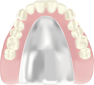 チタン床義歯